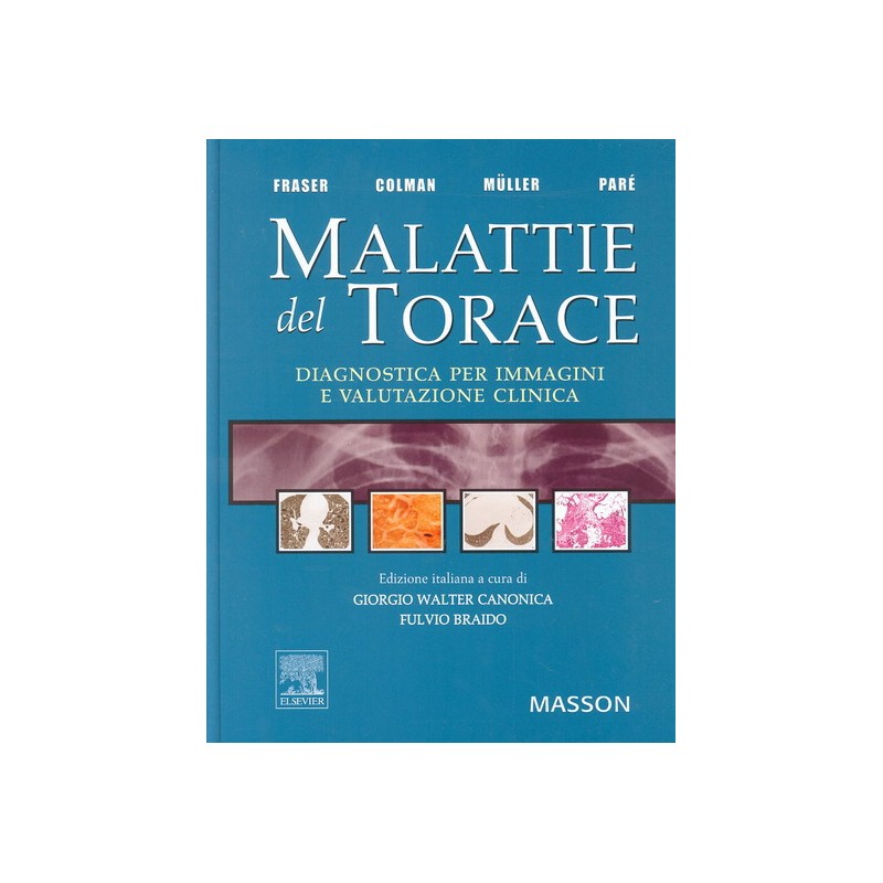 Malattie del torace - DIAGNOSTICA PER IMMAGINI E VALUTAZIONE CLINICA